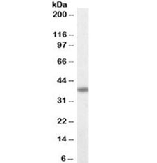 Western blot testing of MOLT4 lysate with FAS antibody at 0.1ug/ml. Predicted molecular weight ~38kDa.