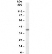 Western blot testing of MOLT4 lysate with Fas antibody at 0.1ug/ml. Predicted molecular weight: ~38 kDa (unmodified), 40-55 kDa (glycosylated).