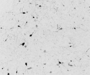 IHC testing of frozen human hypothalamus with Calbindin 1 antibody at 0.1ug/ml. A biotin secondary followed by SAv-HRP and DAB were used for the staining. Image courtesy of Prof. Erik Hrabovszky, Institute of Experimental Medicine, Budapest, Hungary.
