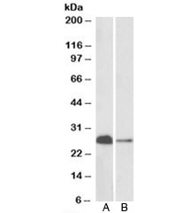 Western blot of mouse (A) and rat (B) brain lysates with Calbindin 1 antibody