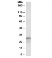 Western blot testing of human cerebellum lysate with Calbindin 1 antibody at 0.03ug/ml. Predicted molecular weight: ~30 kDa, routinely observed at 27-28 kDa.