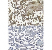 IHC staining of FFPE human placental tissue with ENPP1 antibody at 5ug/ml (top) and without primary antibody (bottom). Required HIER: steamed antigen retrieval with pH6 citrate buffer; HRP-staining.