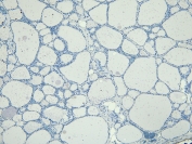 Negative control: IHC staining of FFPE human thyroid gland tissue without primary antibody. HIER: steamed with pH6 citrate buffer, HRP-staining.
