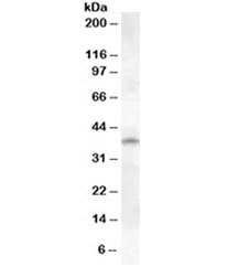 Western blot testing of human lung lysate with Cathepsin K antibody at 1ug/ml. Predicted molecular weight ~37 kDa, with an ~46 kDa pro form and an ~27 kDa mature form.
