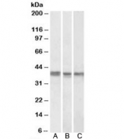 Western blot testing of K562 [A], MCF7 [B] and mouse liver [C] lysates with POLDIP2 antibody at 1ug/ml. Although the theoretical mass is ~42 kDa, POLDIP2 contains an N-terminal mitochondrial targeting sequence that is cleaved upon import, producing a mature ~37 kDa species that predominates in endogenous samples.