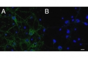 IHC staining of primary rat cortical neurons showing localization of IFT74 to vesicles in the cell body and along the neuronal processes using IFT74 antibody at 2.5ug/ml. B) unstained control.