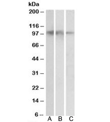Western blot testing of human hippocampus [A], cerebral cortex [B] and cerebellum [C] lysates with NTRK2 antibody at 0.05ug/ml. Predicted molecular weight: ~94kDa.
