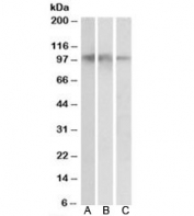 Western blot testing of human hippocampus [A], cerebral cortex [B] and cerebellum [C] lysates with NTRK2 antibody at 0.05ug/ml. Expected molecular weight: 90~140 kDa, depending on glycosylation level.