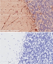 IHC testing of FFPE human cerebellum tissue with (top) and without (bottom) Doublecortin antibody at 2ug/ml. HIER: steam section in pH6 citrate buffer for 20 min.