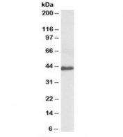 Western blot testing of human colorectal cancer lysate with Fractalkine antibody at 0.3ug/ml. Predicted molecular weight: ~42kDa.