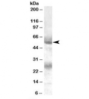 Western blot testing of human bone marrow lysate with FLVCR antibody at 0.1ug/ml. The expected ~55kDa band and the additional ~26kDa band are blocked by the immunizing peptide.