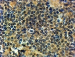 IHC staining of FFPE human tonsil with PRDM1 antibody at 2ug/ml. HIER: steamed with pH9 Tris/EDTA buffer, HRP-staining.