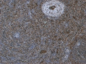 IHC staining of FFPE human tonsil with PRDM1 antibody at 2ug/ml. HIER: steamed with pH9 Tris/EDTA buffer, HRP-staining.