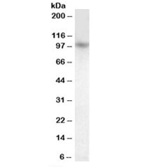 Western blot testing of human cerebellum lysate with PRDM1 antibody at 1ug/ml. Predicted molecular weight: ~92/77kDa (isoforms 1/2).~