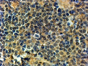 IHC staining of FFPE human tonsil with PRDM1 antibody at 2ug/ml. HIER: steamed with pH9 Tris/EDTA buf