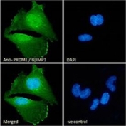 IF/ICC staining of fixed and permeabilized human U-251 cells with PRDM11 antibody (green) at 10ug/ml and DAPI nuclear stain (blue).