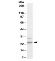 Western blot testing of HEK293 lysate with MAD2L1 antibody at 2ug/ml. The expected ~24kDa band and the additional ~29kDa band are blocked by the immunizing peptide.