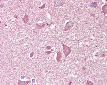IHC testing of FFPE human cortex (brain) tissue with NCAM2 antibody at 3.75ug/ml. Required HIER: steamed antigen retrieval with pH6 citrate buffer; AP-staining.