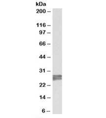 Western blot testing of human heart lysate with TNNI3 antibody at 0.2ug/ml. Predicted molecular weight: ~24kDa, can also observed at ~28kDa.~