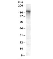 Western blot testing of human breast lysate with MRP8 antibody at 0.5ug/ml. Predicted molecular weight: ~154/150kDa (isoforms 1/2), observed here at ~125kDa.~