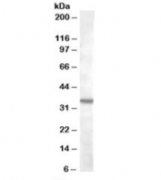 Western blot testing of K562 lysate with BDKRB1 antibody at 2ug/ml. Predicted molecular weight: ~40kDa, but can be observed at ~35kDa.