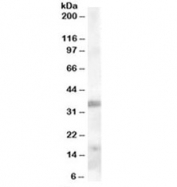 Western blot testing of human tonsil lysate with TIM-3 antibody at 0.3ug/ml. Expected molecular weight: 33-70 kDa depending on glycosylation level.