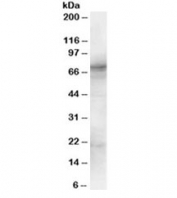 Western blot testing of human spleen lysate with SYK antibody at 1ug/ml. Predicted molecular weight: 72 kDa.