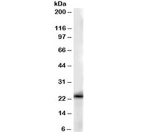 Western blot testing of human kidney lysate with GSTP1 antibody at 0.01ug/ml. Predicted molecular weight ~23kDa.