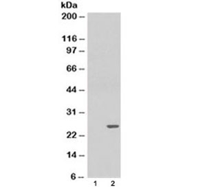 Western blot of HEK293 lysate overexpressing GSTP1 probed with GSTP1 antibody (mock transfection in lane 1). Predicted molecular weight ~23kDa.