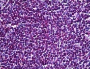 IHC testing of FFPE human spleen tissue with UBR5 antibody at 3.75ug/ml. HIER: steamed antigen retrieval with pH6 citrate buffer; AP-staining.