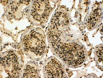 IHC testing of FFPE human testis with UBR5 antibody at 4ug/ml. HIER: steamed with pH9 Tris/EDTA buffer, HRP-staining. The antigen reveal step is REQUIRED for UBR5 detection.~