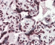 IHC testing of FFPE human placenta with HMGA1 antibody at 4ug/ml. HIER: steamed with pH6 citrate buffer, AP-staining.