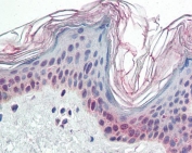 IHC testing of FFPE human skin with PARP2 antibody at 5ug/ml. Required HIER: steamed antigen retrieval with pH6 citrate buffer; AP-staining.