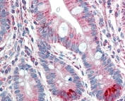 IHC testing of FFPE human small intestine tissue with TMPRSS5 antibody at 5ug/ml. Required HIER: steamed antigen retrieval with pH6 citrate buffer; AP-staining.