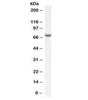 Western blot testing of Jurkat cell lysate (nuclear fraction) with FANCG antibody at 1ug/ml. Predicted molecular weight: ~69 kDa.
