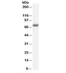 Western blot testing of HeLa cell lysate with FANCG antibody at 0.5ug/ml. Predicted molecular weight: ~69kDa.