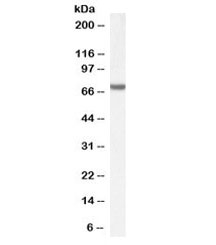Western blot testing of Jurkat cell lysate (nuclear fraction) with FANCG antibody at 1ug/ml. Predicted molecular weight: ~69 kDa.