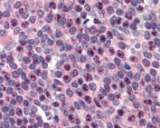 IHC testing of FFPE human spleen tissue with FANCG antibody at 3ug/ml. Required HIER: steamed antigen retrieval with pH6 citrate buffer; AP-staining.