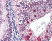 IHC testing of FFPE human uterus tissue with FANCG antibody at 3ug/ml. Required HIER: steamed antigen retrieval with pH6 citrate buffer; AP-staining.