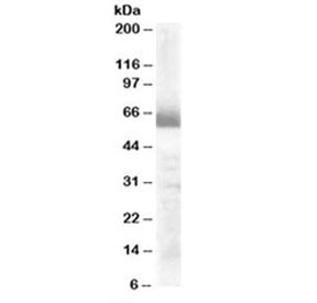 Western blot testing of human ovay lysate with CYP17A1 antibody at 0.3ug/ml. Predicted molecular weight: ~57kDa.~