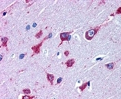 IHC testing of FFPE human cortex with ALS2 antibody at 4ug/ml. HIER: steamed with pH6 citrate buffer, AP-staining.