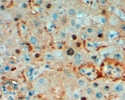 IHC staining of FFPE human liver at 2ug/ml. HIER: steamed with pH9 Tris/EDTA buffer, HRP-staining.