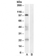 Western blot testing of human brain lysate with Nogo 66 receptor antibody at 0.3ug/ml with [B] and without [A] blocking/immunizing peptide