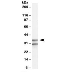 Western blot testing of human brain frontal cortex lysate with GPR3 antibody at 0.3ug/ml. The expected ~35kDa band and the additional ~30kDa band are both blocked by the immunizing peptide.