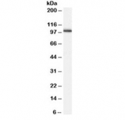 Western blot testing of human testis lysate with ADAM17 antibody at 0.2ug/ml. Expected size: 80-130 kDa depending on level of glycosylation