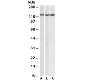 Western blot testing of Daudi (A), Jurkat (B) and HeLa (C) lysates with ADAM17 antibody at 0.3ug/ml. Expected molecular weight: 80-130KD depending on level of glycosylation