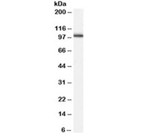 Western blot testing of human testis lysate with ADAM17 antibody at 0.2ug/ml. Expected size: 80-130KD depending on level of glycosylation