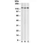 Western blot testing of Daudi (A), Jurkat (B) and HeLa (C) lysates with ADAM17 antibody at 0.3ug/ml. Expected molecular weight: 80-130 kDa depending on level of glycosylation