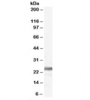 Western blot testing of human testis lysate with Ribosomal Protein L19 antibody at 0.1ug/ml. Expected molecular weight: 23-28 kDa.