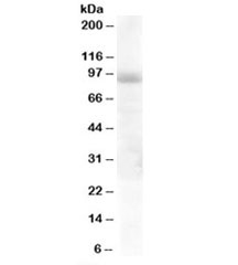 Western blot testing of human lung lysate with HPS6 antibody at 1ug/ml. Predicted molecular weight: ~83kDa, observed here at ~95kDa.